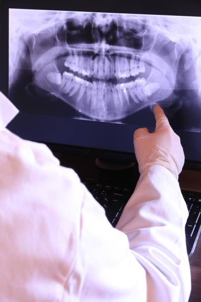 Best Knocked-Out Tooth Emergency  in Springfield, MA