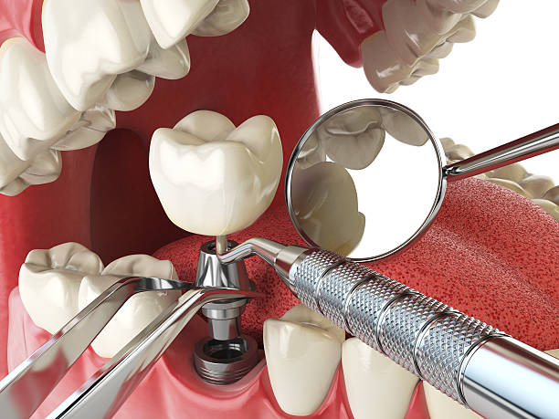 Emergency Gum Pain Relief in MA